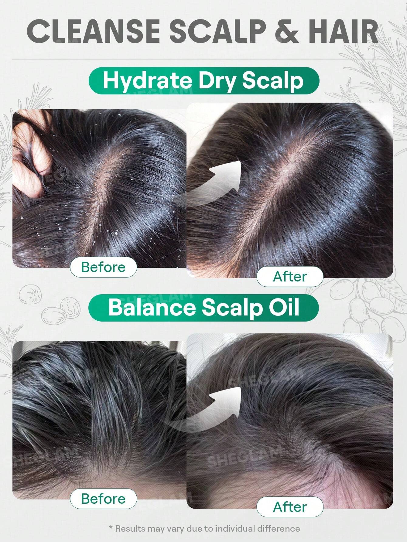 Rosemary Hair And Scalp Oil -15ml