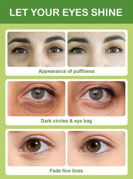 SLOWSUNDAY™ Aloe Vera Hydrating Undereye Mask 10pcs