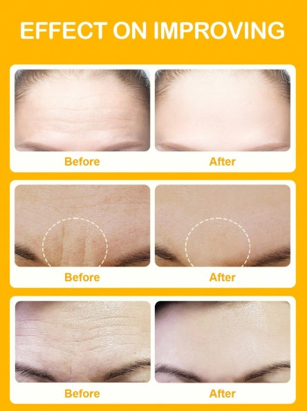 SLOWSUNDAY™ Niacinamide Forehead Patch 5pcs