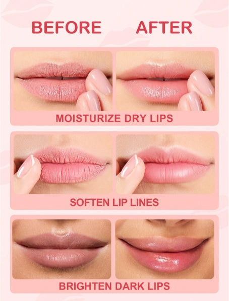 SLOWSUNDAY™ Peach Moisturizing Lip Mask 5pcs