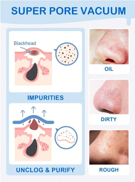 SLOWSUNDAY™ Blackhead Remover Nose Strips 10pcs