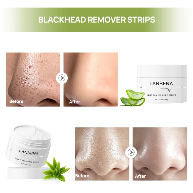 LANBENA Nose Plants Pore Strips