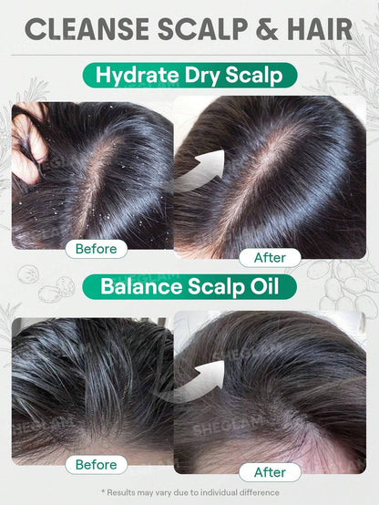 Rosemary Hair And Scalp Oil -15ml