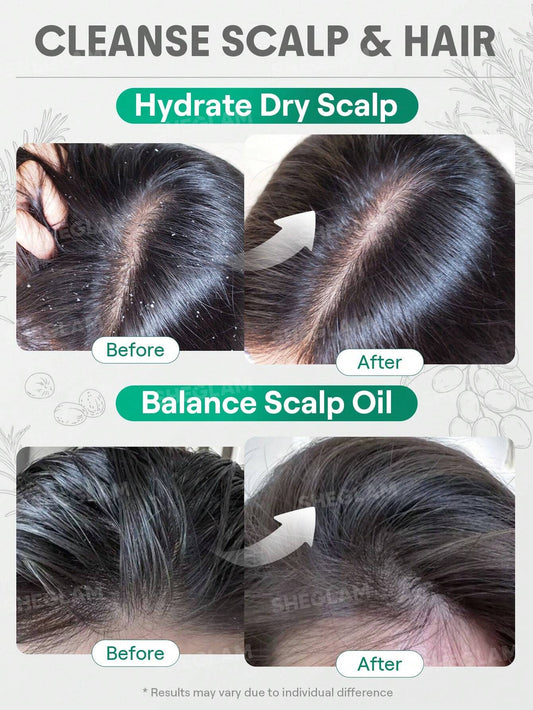Rosemary Hair And Scalp Oil -15ml