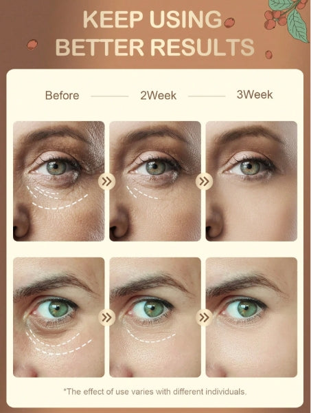 SLOWSUNDAY™ Under Eye Brightening Coffee Gel 15ml