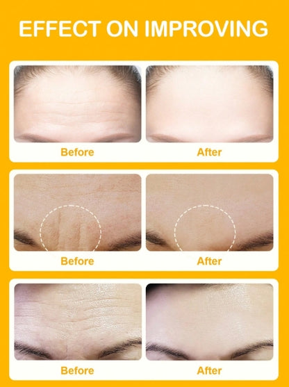SLOWSUNDAY™ Niacinamide Forehead Patch 5pcs