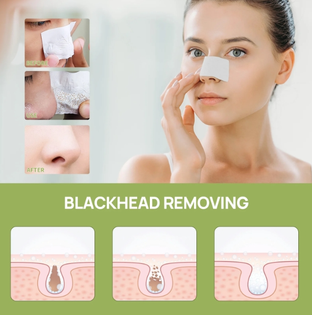LANBENA Nose Plants Pore Strips