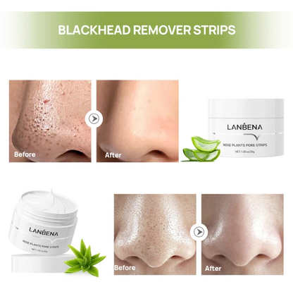 LANBENA Nose Plants Pore Strips